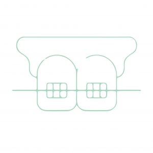 niềng răng tại nha khoa 360 dental