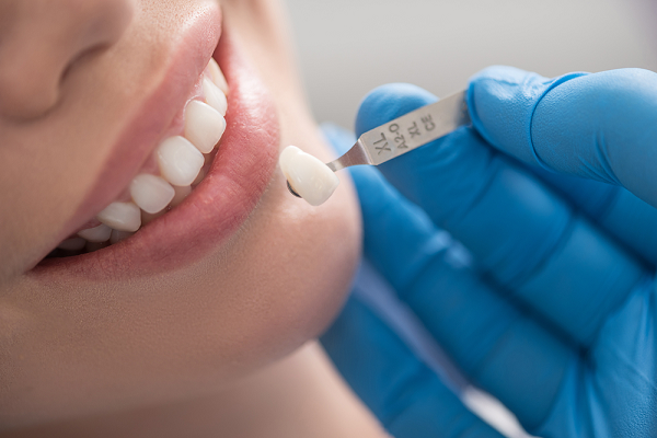 Thẩm mỹ răng sứ tại Nha khoa 360 Dental